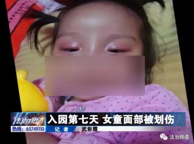 平頂山3歲女童上幼兒園 入園7天突然發(fā)生意外