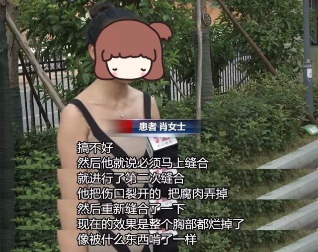 女子花近十萬(wàn)做豐胸手術(shù) 術(shù)后胸部潰爛似被啃