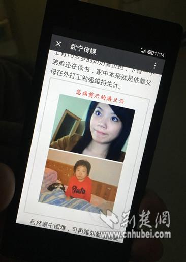 25歲少女患怪病“逆生長” 半年矮了13厘米(圖)