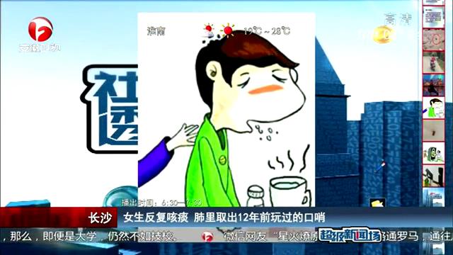 女生反復(fù)咳痰 肺里取出12年前玩過的口哨